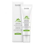 Kem dưỡng ẩm trị mụn Babe Stop AKN Mattifying Moisturiser