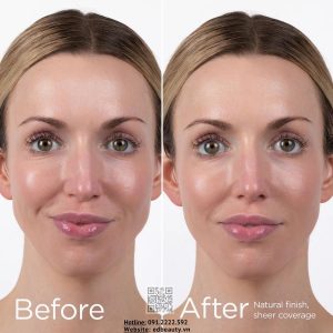 Kem chống nắng cho da nhạy cảm ELTAMD UV PHYSICAL BROAD SPECTRUM SPF 41 (5)