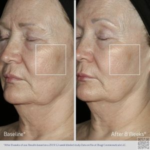 Serum nâng cơ chống lão hóa Obagi Elastiderm Firming Facial Serum