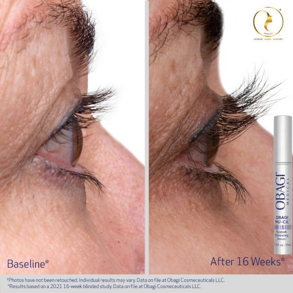 Serum mọc mi Obagi Nu-Cil Eyelash Enhancing Serum - Hình ảnh 5