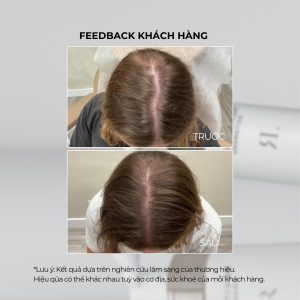 Revitalash Volume Enhancing Foam - Tinh chất nuôi dưỡng và kích thích mọc tóc