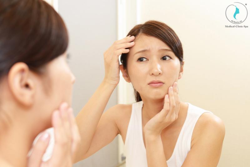 Các nguyên nhân phổ biến khiến da xỉn màu