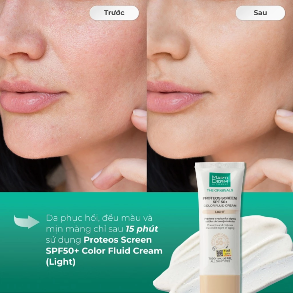 Kem chống nắng MartiDerm The Originals Proteos Screen SPF50+ Fluid Cream - Hình ảnh 6