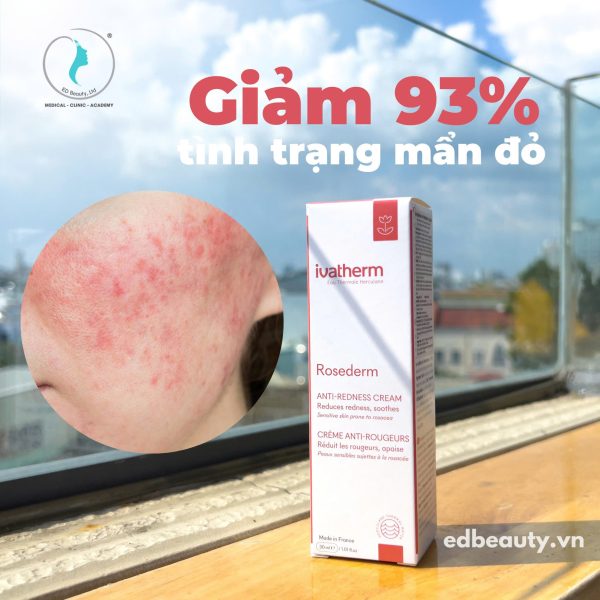 Kem dưỡng giảm mẩn đỏ Ivatherm Rosederm Cream For Couperosic Sensitive Skin - Hình ảnh 3