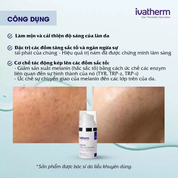 Serum đặc trị nám Ivatherm Ivawhite Intensive Whitening Serum - Hình ảnh 4