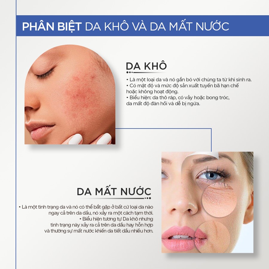 GIẢI PHÁP IMAGE SKINCARE CHO LÀN DA KHÔ VÀ DA MẤT NƯỚC | Ed beauty