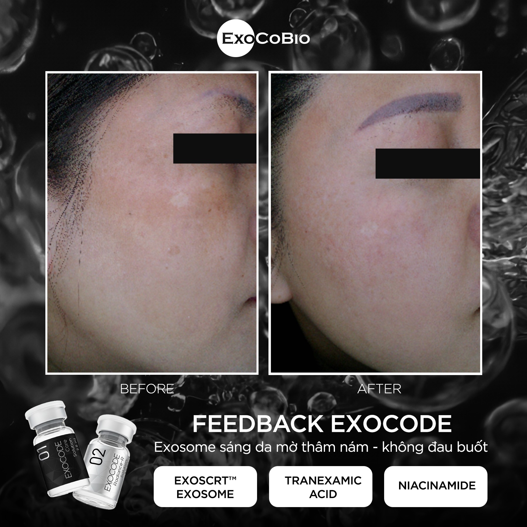 Set tinh chất Exocode Radiance - R cấy làm sáng da và điều trị nám (Set liệu trình 3 cặp) - Hình ảnh 4