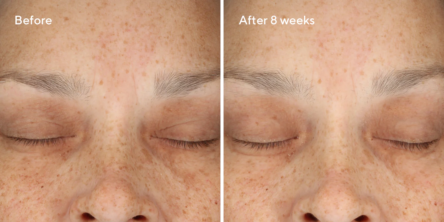 Hiệu quả sử dụng viên uống Murad sau 8 tuần (Nguồn: Murad)
