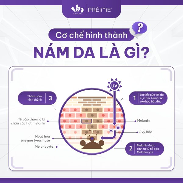 (Cơ chế hình thành nám & hướng khắc phục dùng phương pháp meso)