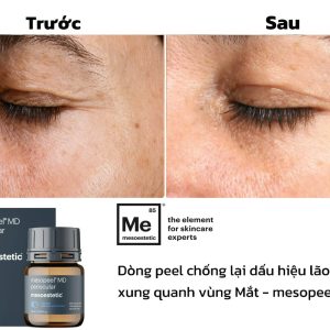 Peel trẻ hóa da mắt Mesoestetic Mesopeel® MD periocular