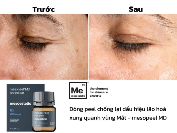 Peel trẻ hóa da mắt Mesoestetic Mesopeel® MD periocular