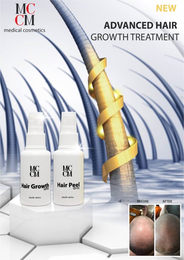 Xịt Tẩy Tế Bào Chết Da Đầu & Xịt Mọc Tóc MCCM Hair Growth Spray & Hair Peel - Hình ảnh 2