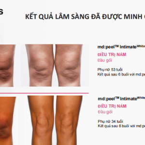 Công dụng sản phẩm MD:ceuticals md:peel IntimateWhite