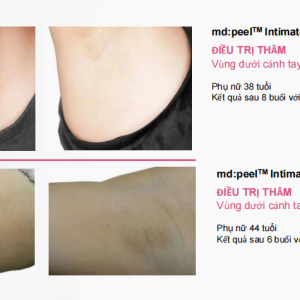 Cung cấp độ âm, tái tạo, làm dịu và sửa chữa da