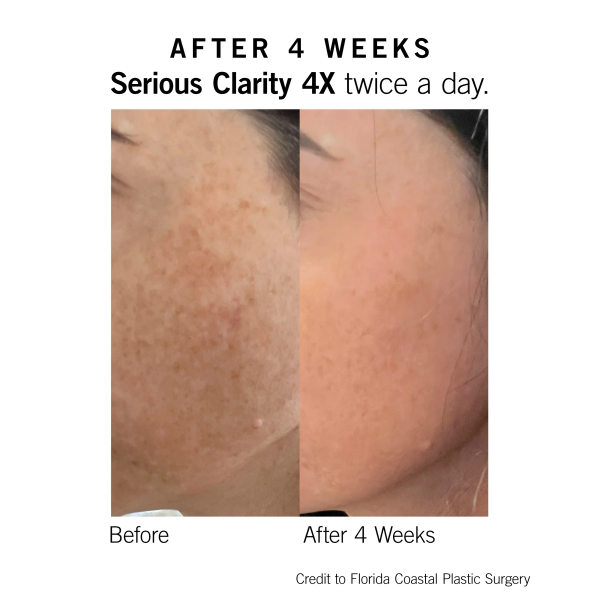 Serum giảm thâm nám, sáng da Neova Serious Clarity 4x - Hình ảnh 2