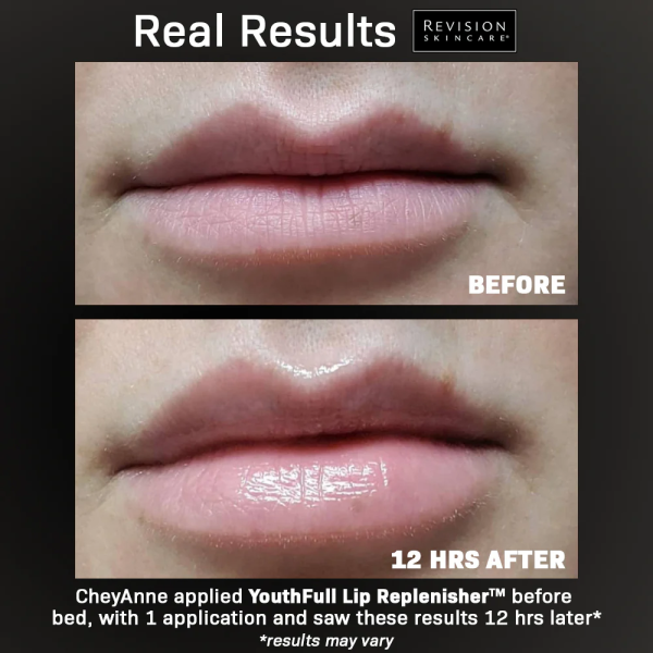 Son dưỡng môi căng trẻ Revision Skincare Youthfull Lip Replenisher - Hình ảnh 3