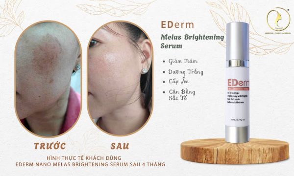 Tinh chất giảm nám, sáng da đều màu EDerm Melas Brightening Serum - Hình ảnh 5