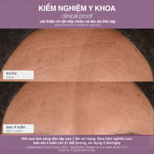 Kem dưỡng ẩm, giảm căng thẳng và sáng đều da Dermalogica Multivitamin Power Recovery Cream - Hình ảnh 5