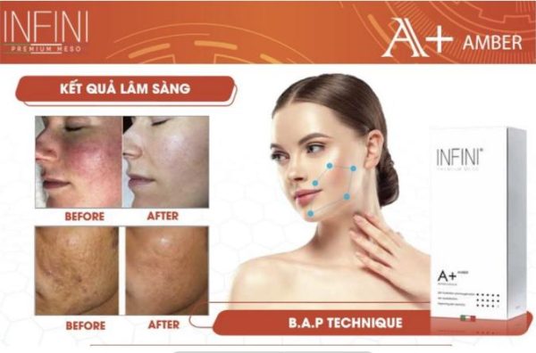 Tinh chất BAP tái tạo, phục hồi da săn chắc trẻ khỏe Infini A+ Amber Booster - Hình ảnh 5
