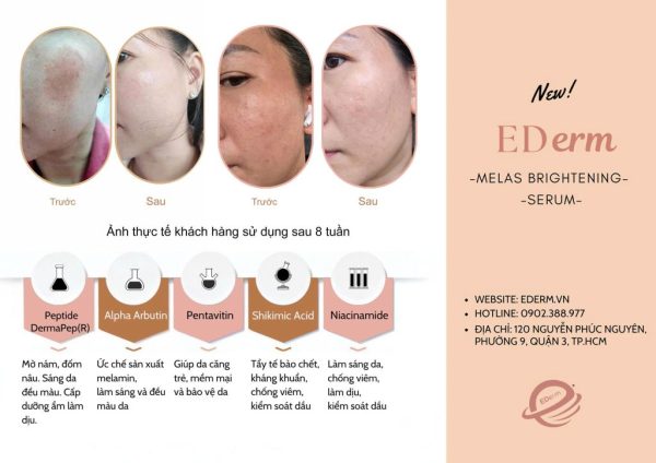 Tinh chất giảm nám, sáng da đều màu EDerm Melas Brightening Serum - Hình ảnh 4