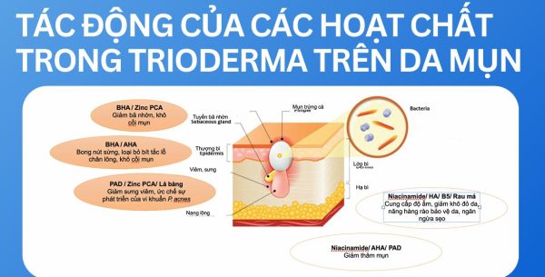 Gel bôi giảm mụn, kháng viêm, mờ thâm Trioderma Anti Acne Gel - Hình ảnh 2
