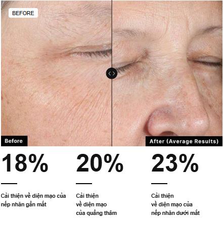 Kết quả rõ rệt Trong một nghiên cứu kéo dài 8 tuần, A.G.E. Advanced Eye đã cải thiện đáng kể diện mạo của các dấu hiệu lão hóa quan trọng rõ rệt. Nguồn: Skinceuticals Kết quả rõ rệtTrong một nghiên cứu kéo dài 8 tuần, A.G.E. Advanced Eye đã cải thiện đáng kể diện mạo của các dấu hiệu lão hóa quan trọng rõ rệt. Nguồn: Skinceuticals