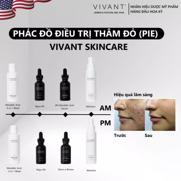 Sữa rửa mặt sạch sáng da, cải thiện mụn Vivant Mandelic Acid 3-in-1 Wash - Hình ảnh 5