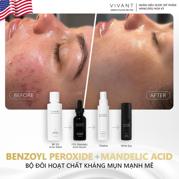 Tinh chất hỗ trợ trị mụn, trẻ hóa da Vivant 15% Mandelic Acid 3-in 1 Serum  - Hình ảnh 5