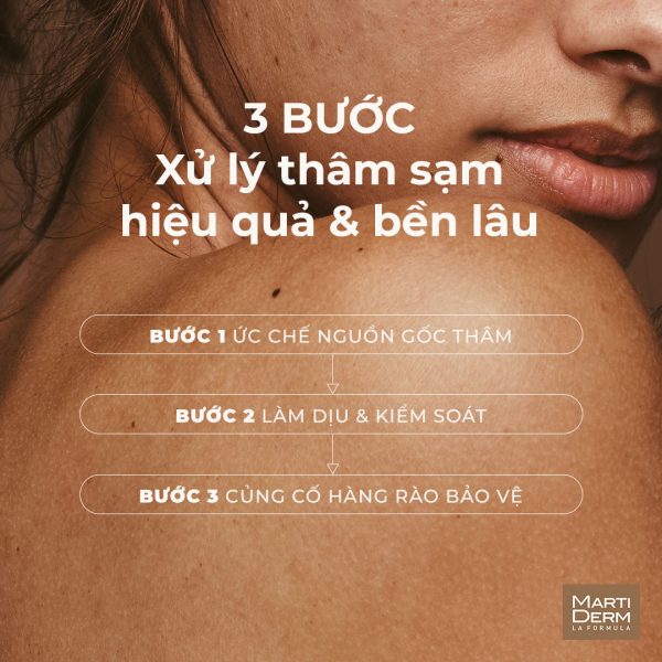 Kem dưỡng thể giảm thâm sạm, sáng mịn da MartiDerm DSP-Specific Body Areas - Hình ảnh 4