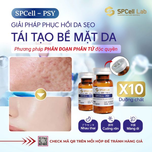 Tinh chất cải thiện sẹo, phục hồi tái tạo da láng mịn SPCell Lab SPCell PSY