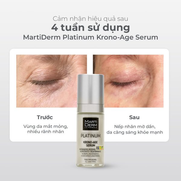  Tinh chất tái tạo trẻ hóa làn da căng mịn MartiDerm Platinum Krono-Age Serum - Hình ảnh 5