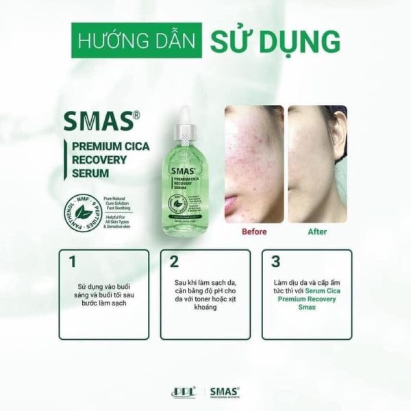Tinh chất làm dịu, phục hồi làn da SMAS Premium Cica Recovery Serum - Hình ảnh 3
