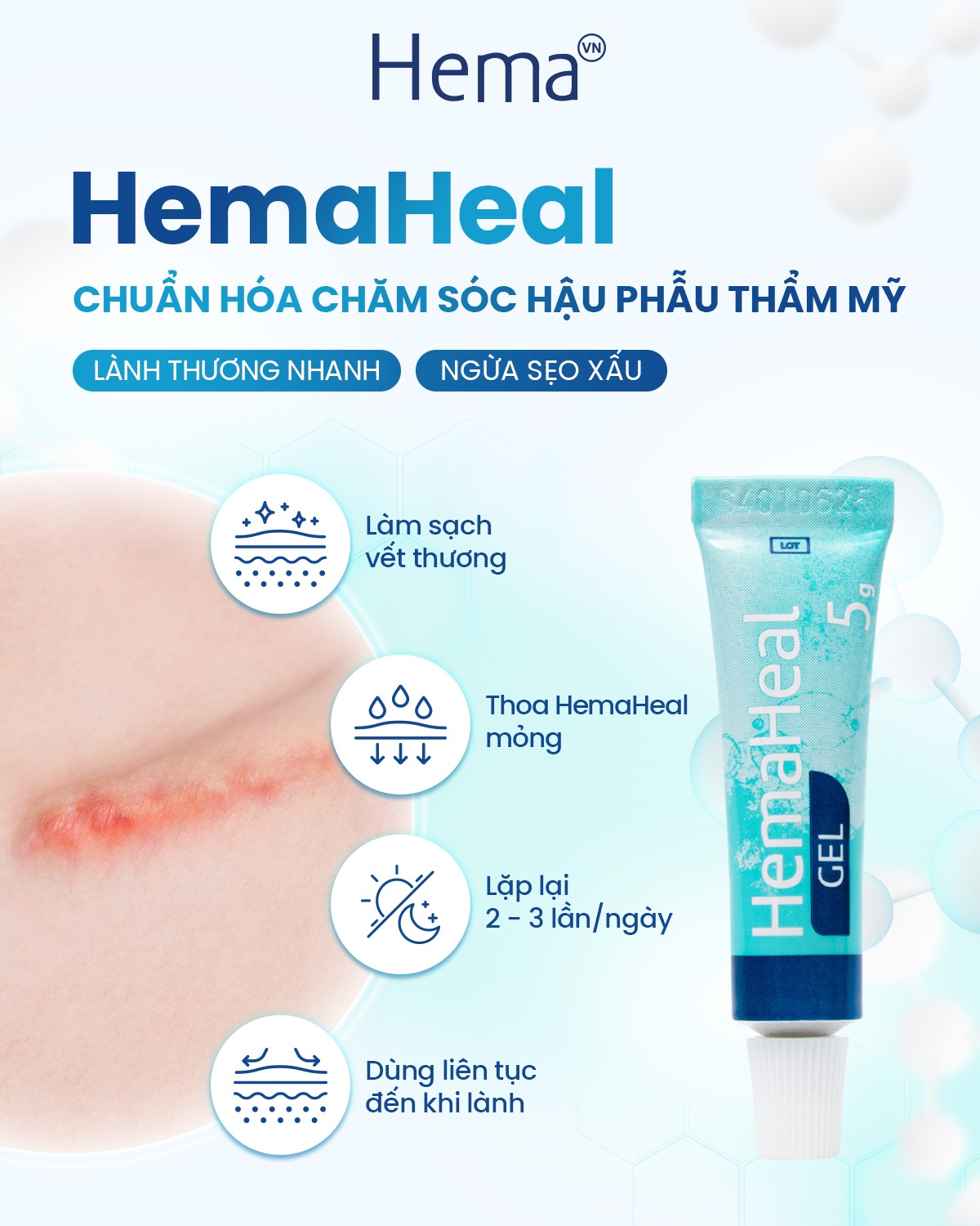 Gel bôi phục hồi, lành vết thương sau phẫu thuật HemaHeal - Hình ảnh 3