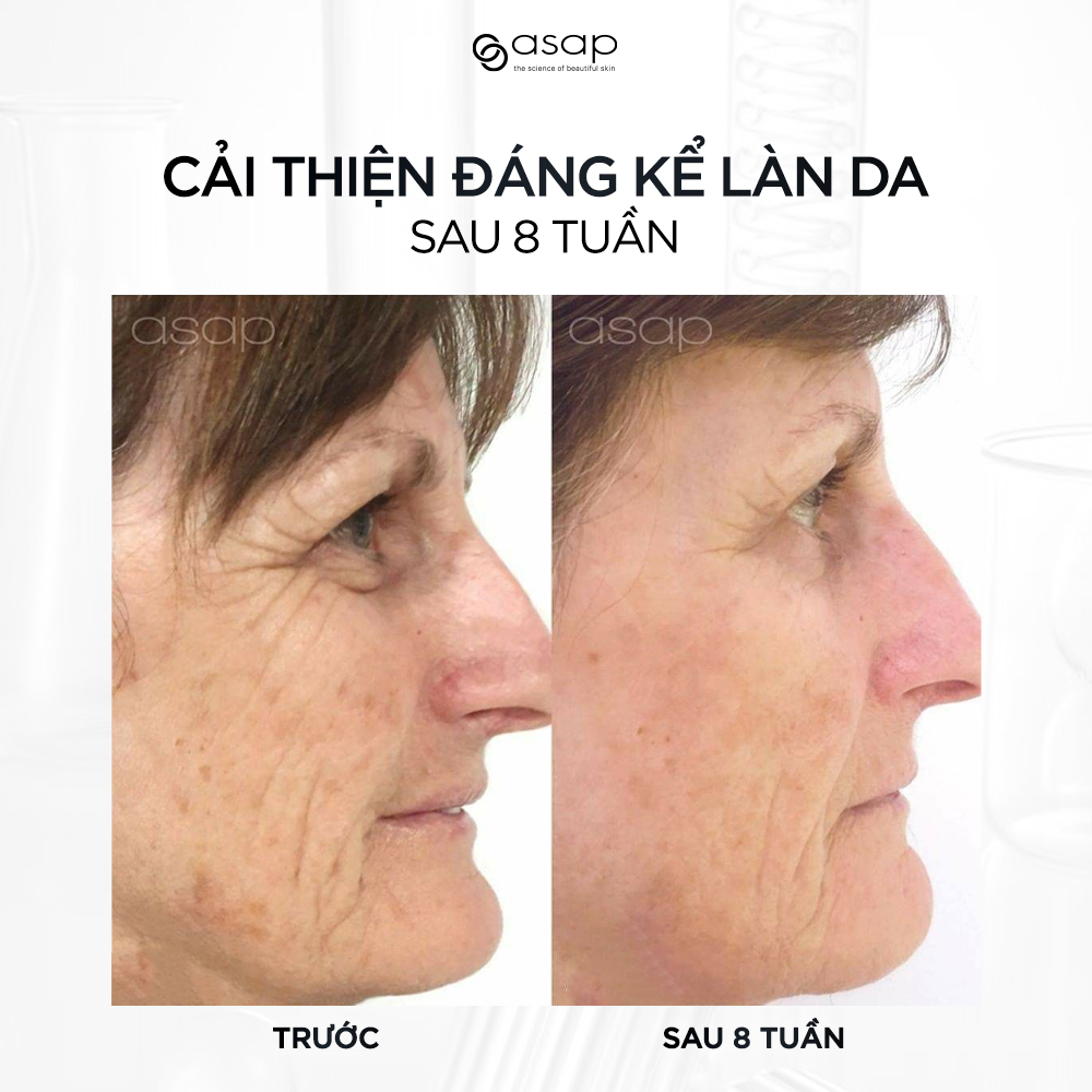 Tinh chất AHA tái tạo da qua đêm, giữ ẩm và sáng mịn da Asap Liquid Platinum - Hình ảnh 4