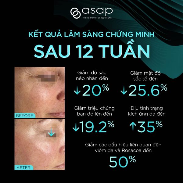 Tinh chất cải thiện lỗ chân lông, giảm lão hóa và làm sáng mịn da Asap N20 Peptide Complex - Hình ảnh 3