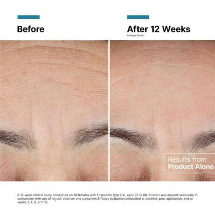 Kem tái tạo sâu đa tầng, giảm đỏ viêm da sau laser SkinCeuticals Advanced RGN-6 - Hình ảnh 6