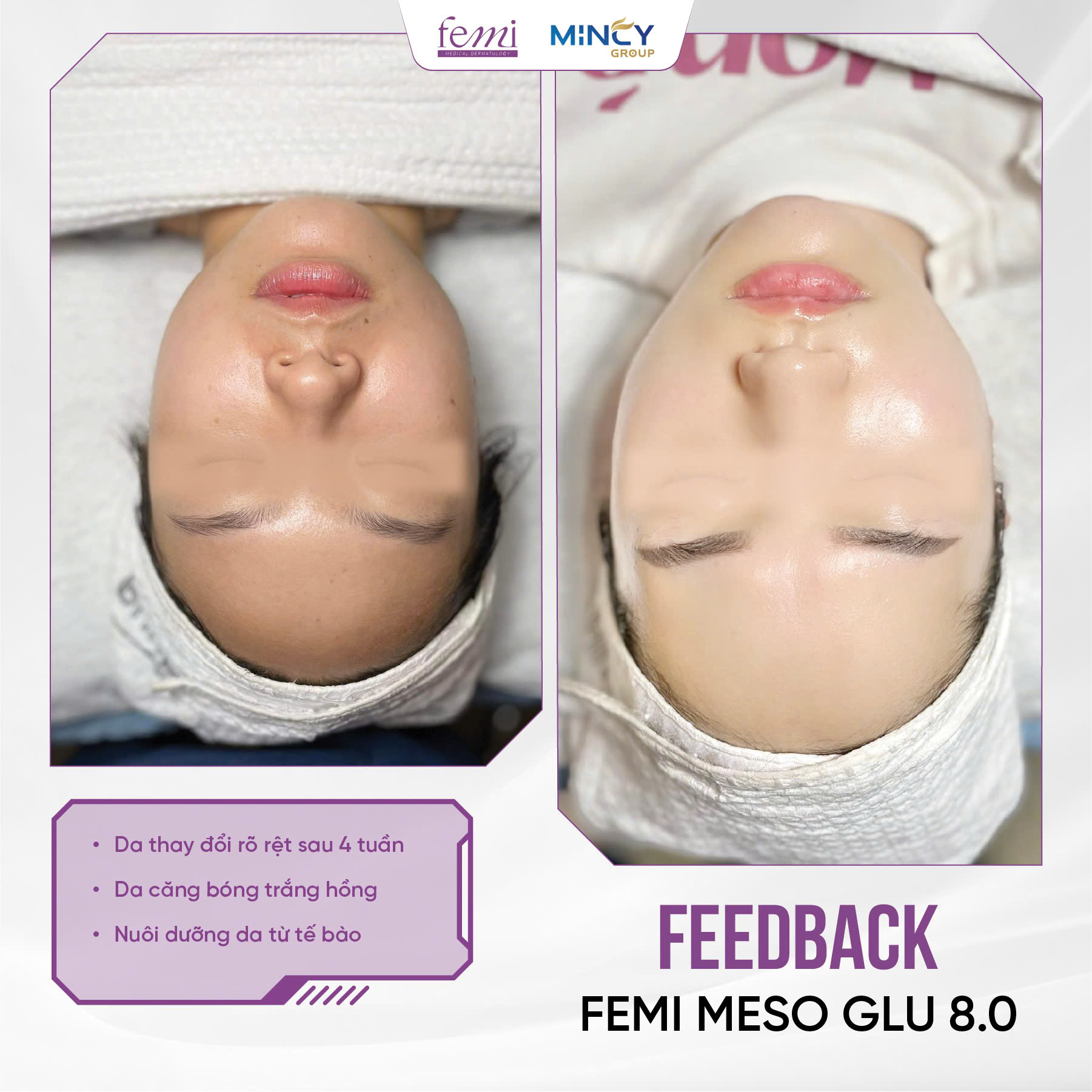 Tinh chất dưỡng trắng hồng, căng bóng da Femi Glu 8.0 - Hình ảnh 7