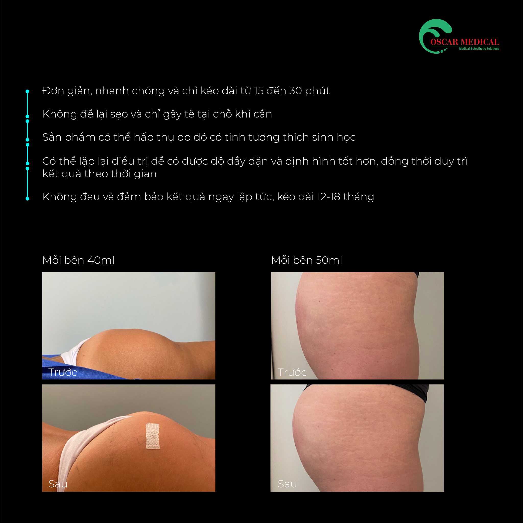 Filler HA làm đầy, trẻ hóa body Skinfill Perfect Line Volume - Hình ảnh 4