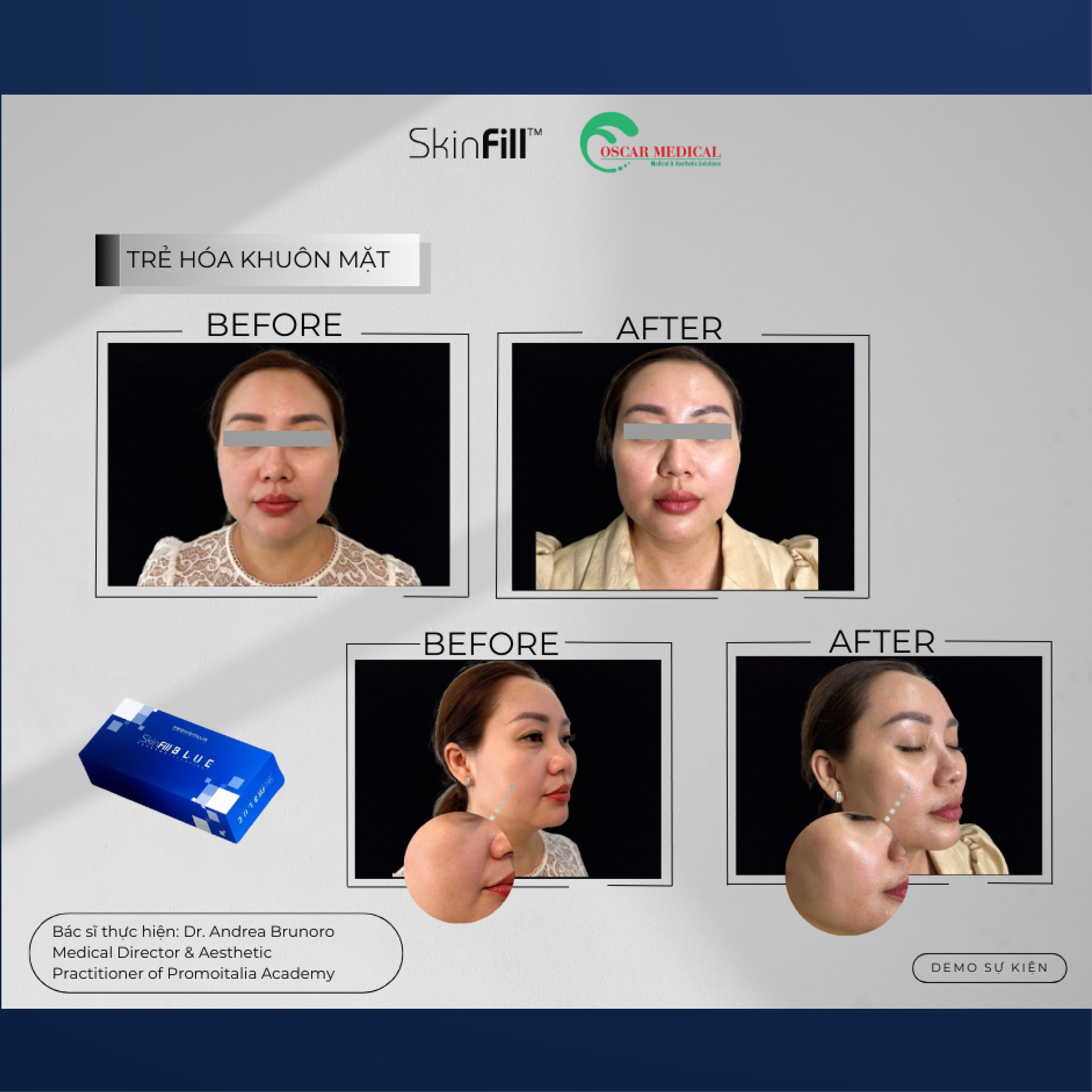 Tinh chất BAP tái tạo đa tầng, phục hồi cấu trúc da Skinfill Blue - Hình ảnh 7