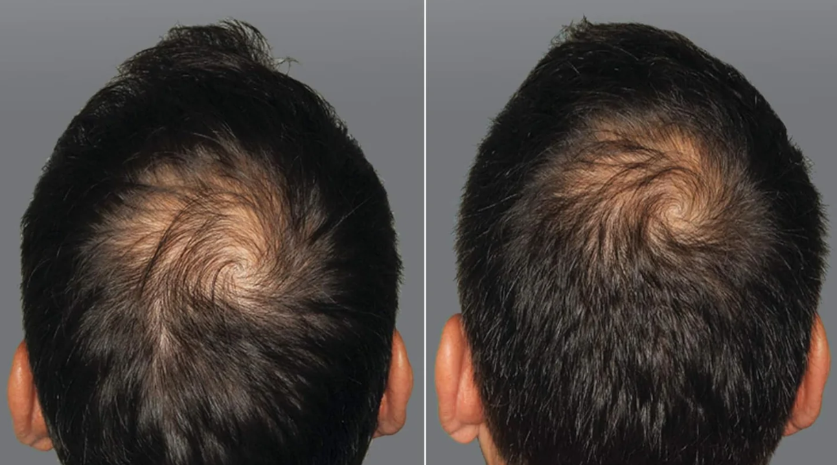 Viên uống hỗ trợ mọc tóc cho nam Viviscal Man Hair Growth Supplements - Ảnh 3