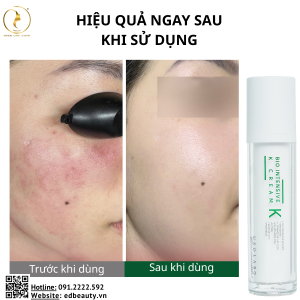 Lợi ích khi dùng Usolab Bio Intensive K Cream