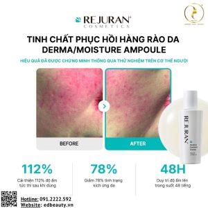 Lợi ích khi dùng Moisture Treatment Ampoule