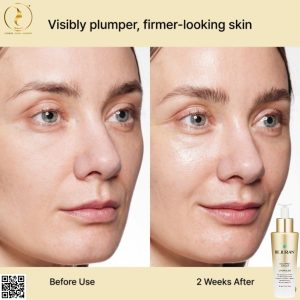 Rejuran Dual Effect Ampoule mang lại hiệu quả gì cho làn da?