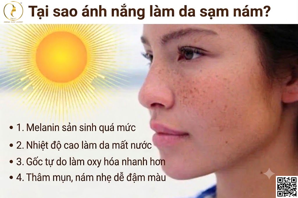 Vì sao mùa hè khiến da dễ sạm nám và không đều màu hơn