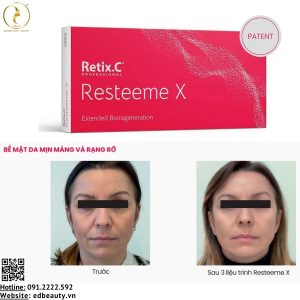 Lợi ích khi sử dụng Resteeme X