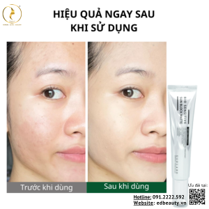 Usolab Bio Sensitive Sun Block Matte phù hợp với?