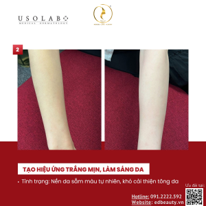 Kem dưỡng trắng body Usolab Bio Intensive Light Cream