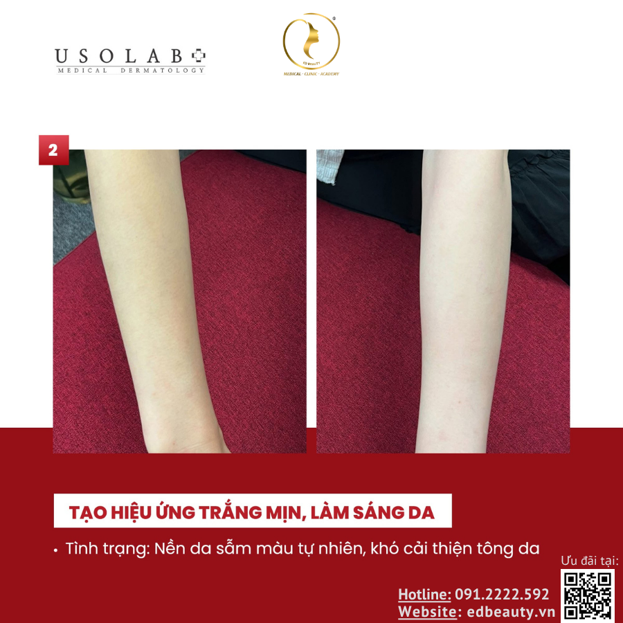Kem dưỡng trắng body Usolab Bio Intensive Light Cream