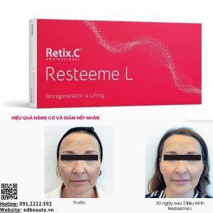 Dung dịch HA tái tạo sinh học, nâng cơ RetixC Resteeme L - Ảnh 4