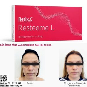 Lợi ích khi sử dụng Resteeme L